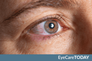 EyeCareTODAY